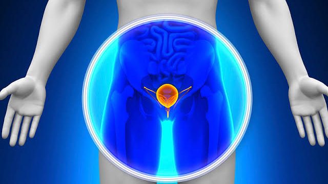 Científico analizando datos genómicos de tumores de cáncer de próstata en laboratorio
