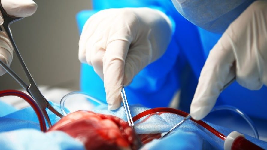 Médicos en quirófano durante procedimiento de trasplante de órganos en España, líder mundial en donación